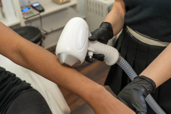 Permanent Laser Hair Removal